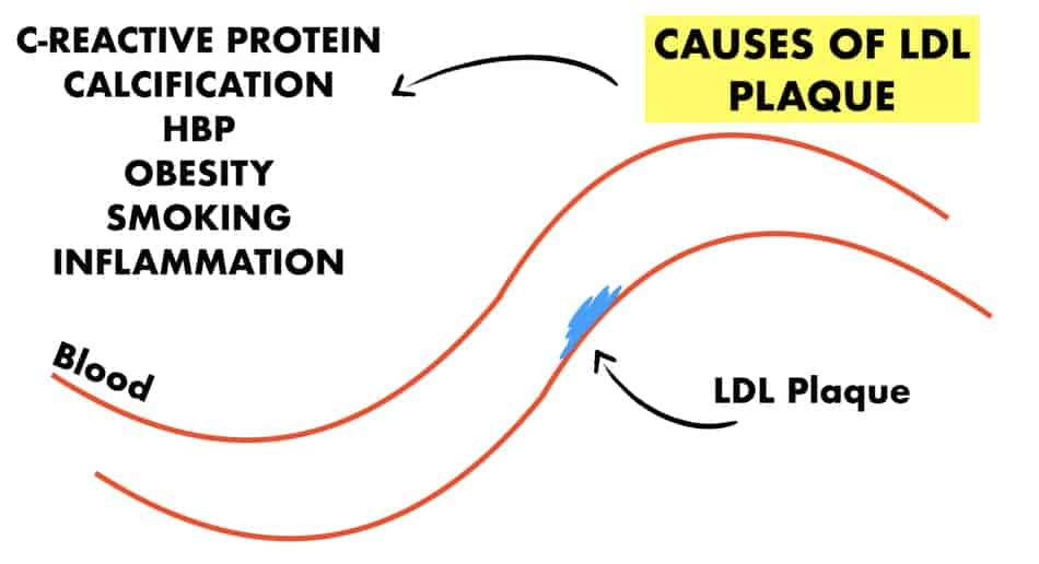 is pork belly bad for cholesterol