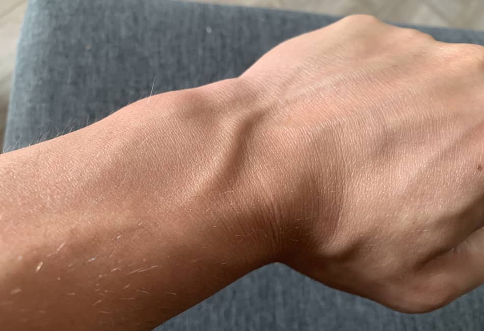 photo of my wrists