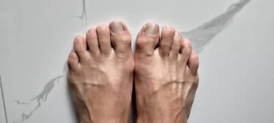 photo of my feet